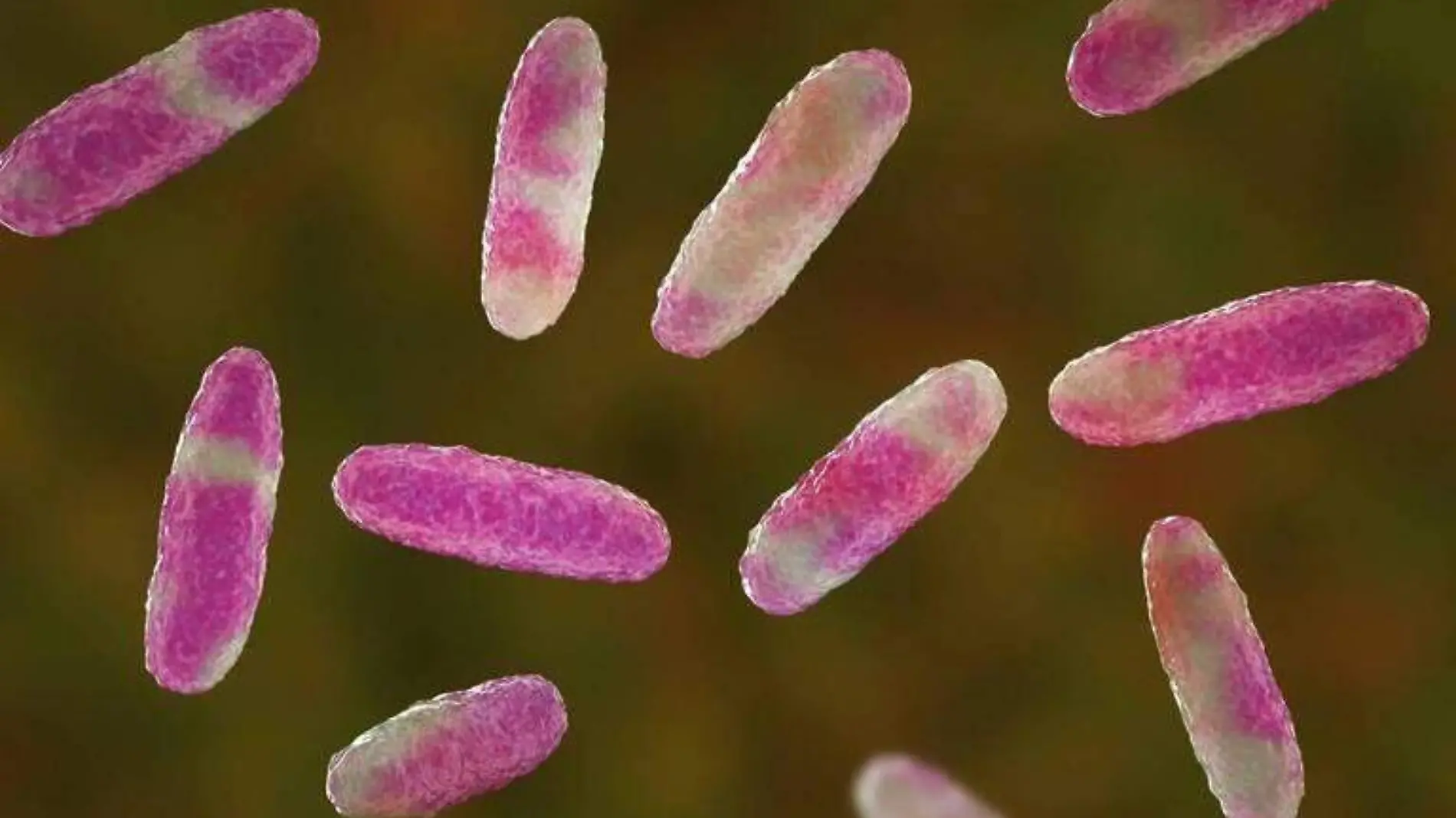 Klebsiella oxytoca